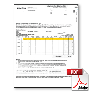 Aetna EOB Full Allowance for Airway Insertion